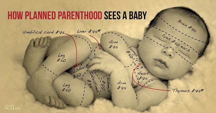 "ABORTION MILLS" - A business venture- True story...click to view more...
